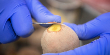 Post control of seed potatoes almost completed: 29 percent lowered in class