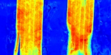 Key Technology Signs Agreement to Deploy Chemical Imaging Technology (CIT®) for Potato Processors
