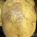 Potato diseases