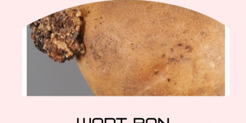 Potential dumping and financial strain as wart ban continues