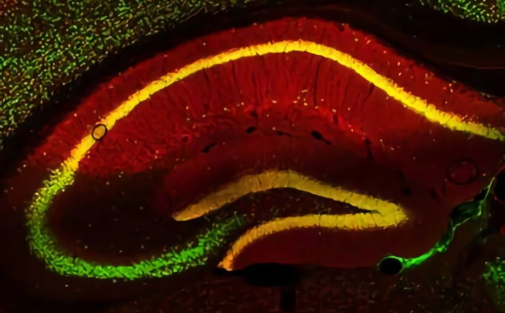 nerve cells of a mouse brain green and the protein prg 1 red If the nerve cells contain prg 1 the cells appear in yellow 1200
