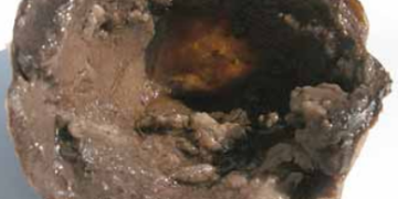 Leak (Pythium ultimum var. ultimum)