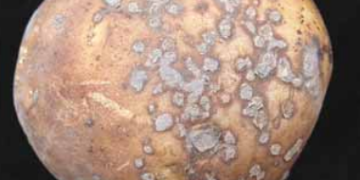 Powdery Scab (Spongospora subterranea)