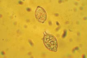 Zaraza ziemniaka (Phytophthora infestans) 2 zwarzyć