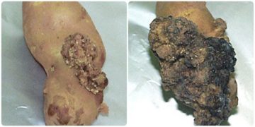 Two New P.E.I. Cases of Potato Wart Discovered by CFIA