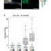 HvRLK4 and HvRLK10 can activate the symbiotic pathway in Medicago. (A) Representative bright-field and YFP fluorescence (transformation control) images of Medicago roots expressing RLK4-2xLaG16 and RLK10-GFP depicted to the right. Scale bar = 1 mm. (B) Number of nodules formed on plants expressing the indicated constructs in the absence of rhizobia. Nodules were counted nine weeks after hairy root transformation. Circles represent individual plants. Numbers below the boxplots specify number of nodulated plants out of total number of plants. Lowercase letters indicate significant differences between samples [analysis of variance (Kruskal-Wallis) and post-hoc analysis (Dunn’s test), p < 0.05]. Credit: Science (2023).