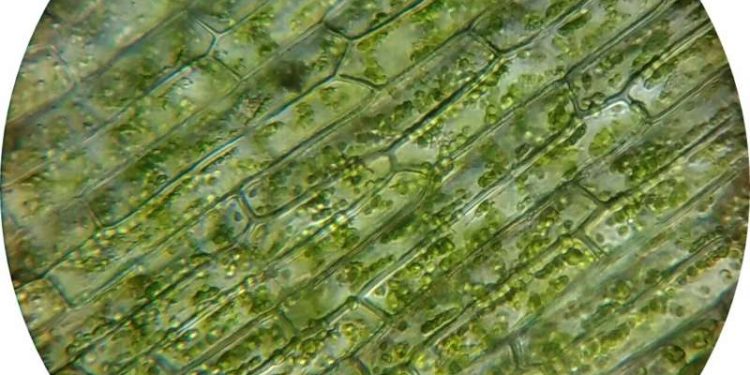 Chloroplasts. Credit: Pixabay/CC0 Public Domain