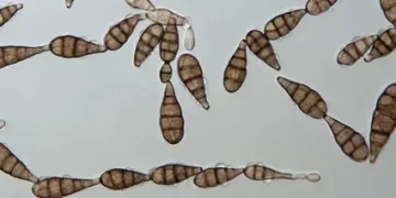 Brown Spot in Agriculture: Understanding Alternaria alternata and Its Impact on Crop Health