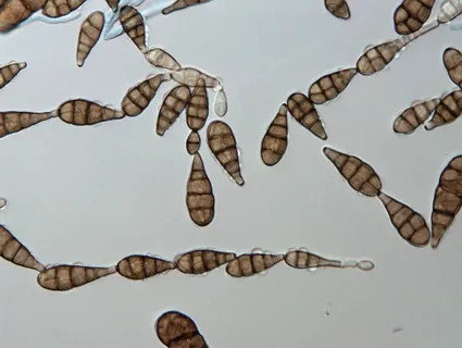 Brown Spot in Agriculture: Understanding Alternaria alternata and Its Impact on Crop Health 43 Brown Spot in Agriculture: Understanding Alternaria alternata and Its Impact on Crop Health