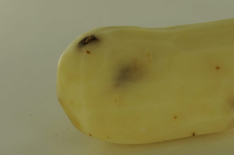 pressure bruise