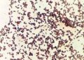 Engineered Bacteria Turn Potato Starch into Biodegradable Bioplastic in Just 24 Hours