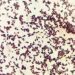 Engineered Bacteria Turn Potato Starch into Biodegradable Bioplastic in Just 24 Hours