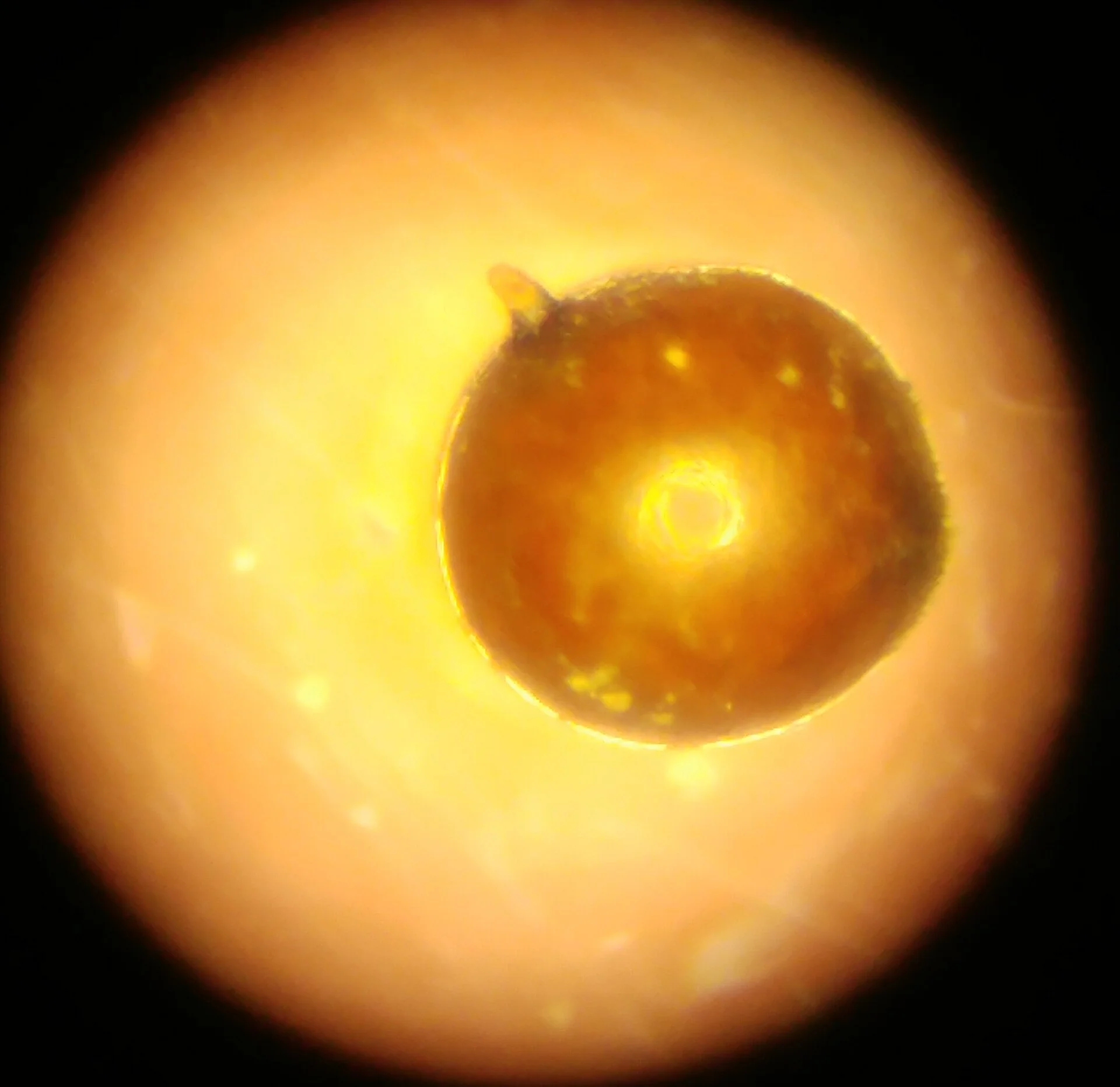 A cyst of the potato cyst nematode (Globodera)