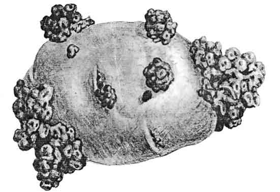 Kursk Region Warns of Devastating Potato Wart Disease as Golden Nematode Also Detected in 2026 2 Kursk Region Warns of Devastating Potato Wart Disease as Golden Nematode Also Detected in 2026