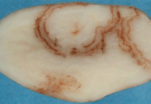 The New Reality: Why Australia’s Shift on PMTV is a Blueprint for Living with Endemic Pathogens